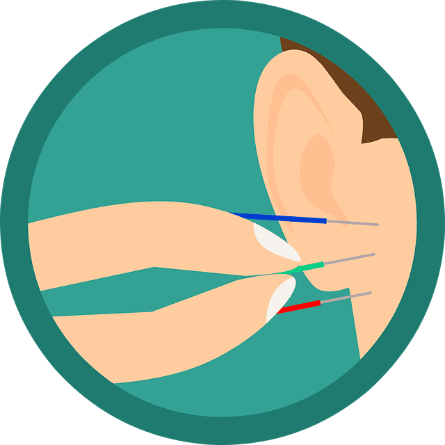 Auriculotherapie