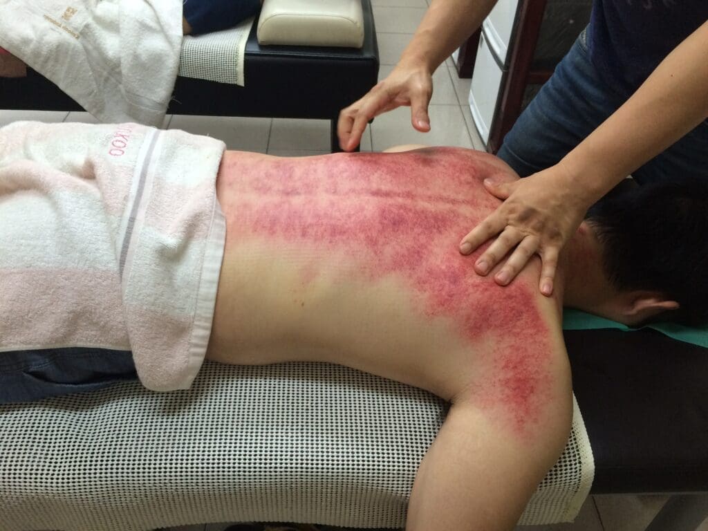 Gua Sha